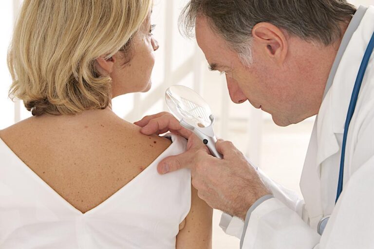 Skin Cancer Treatments: What Are Your Options?